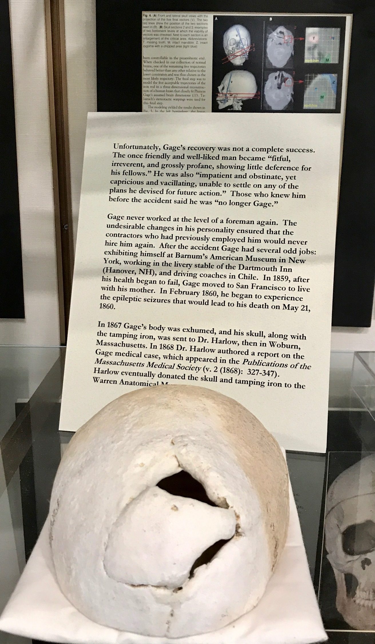 Phineas Gage memorabilia, Warren Anatomical Museum, Boston (by Luca Ambrosio) - 02.jpg